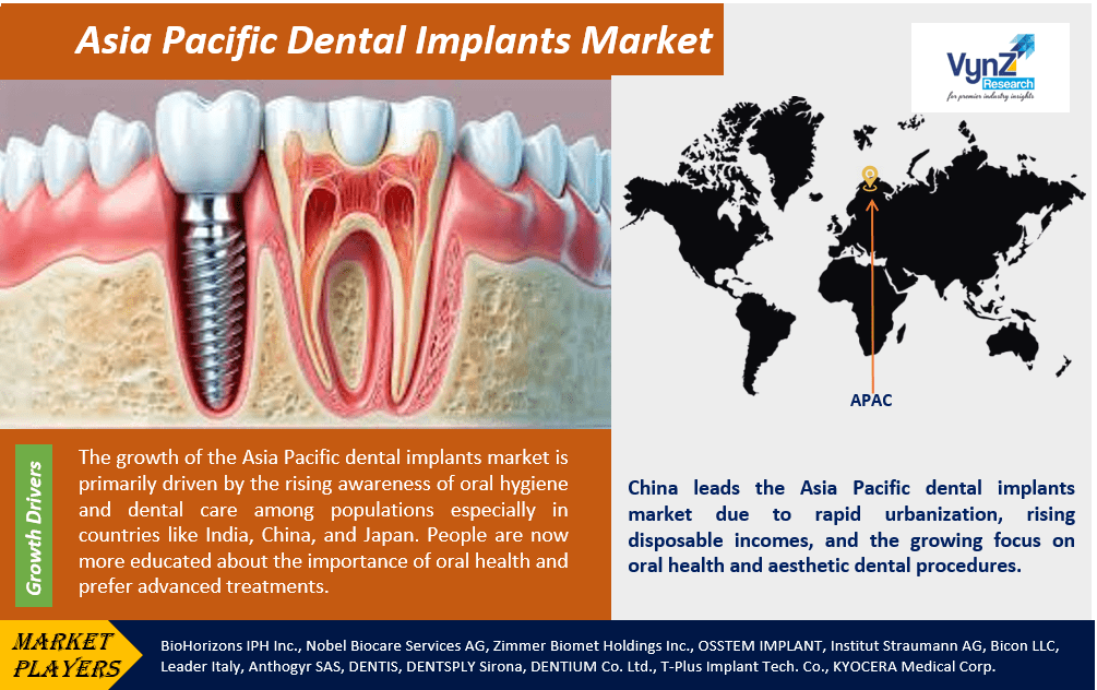 Asia Pacific Dental Implants Market