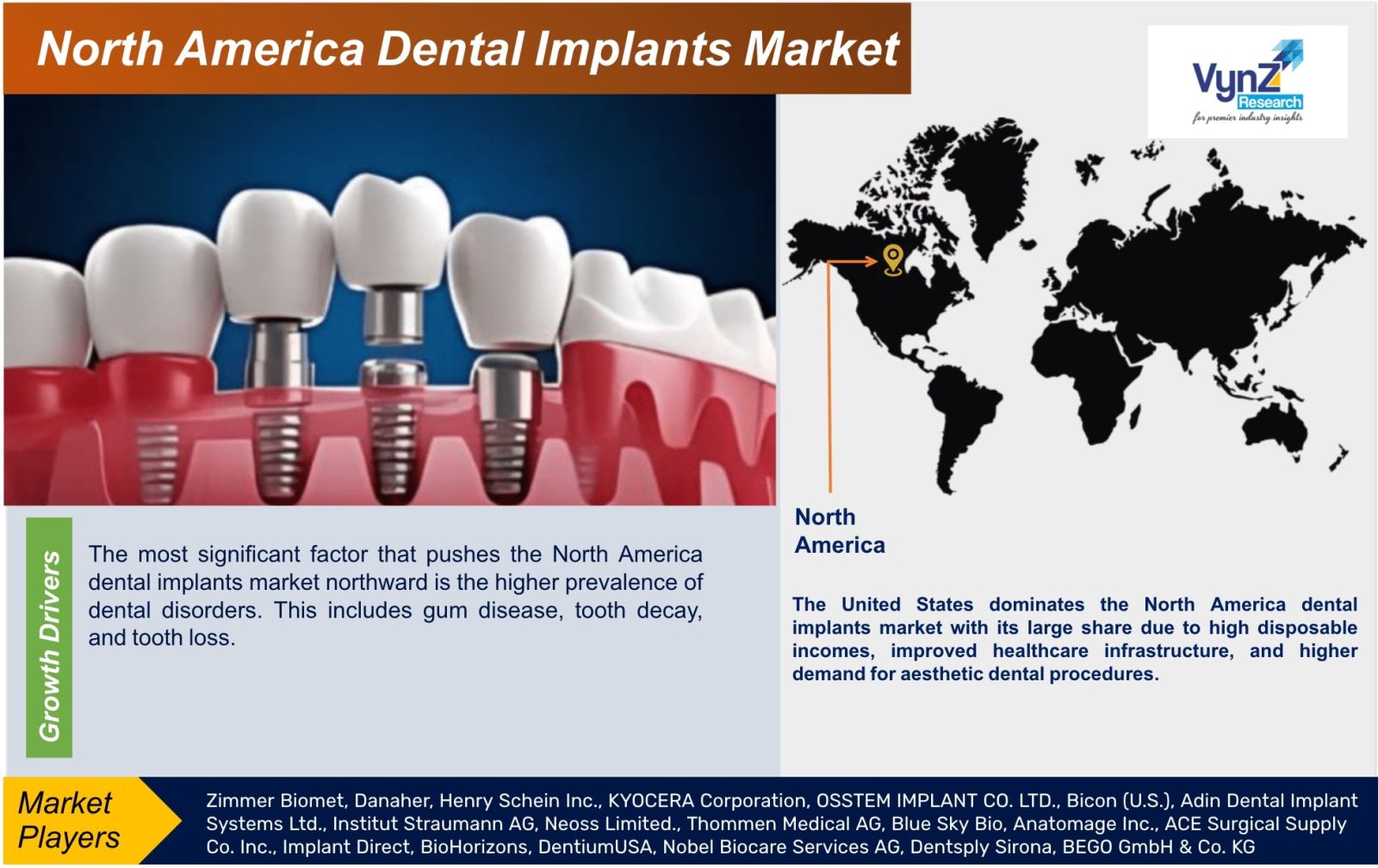 North America Dental Implants Market