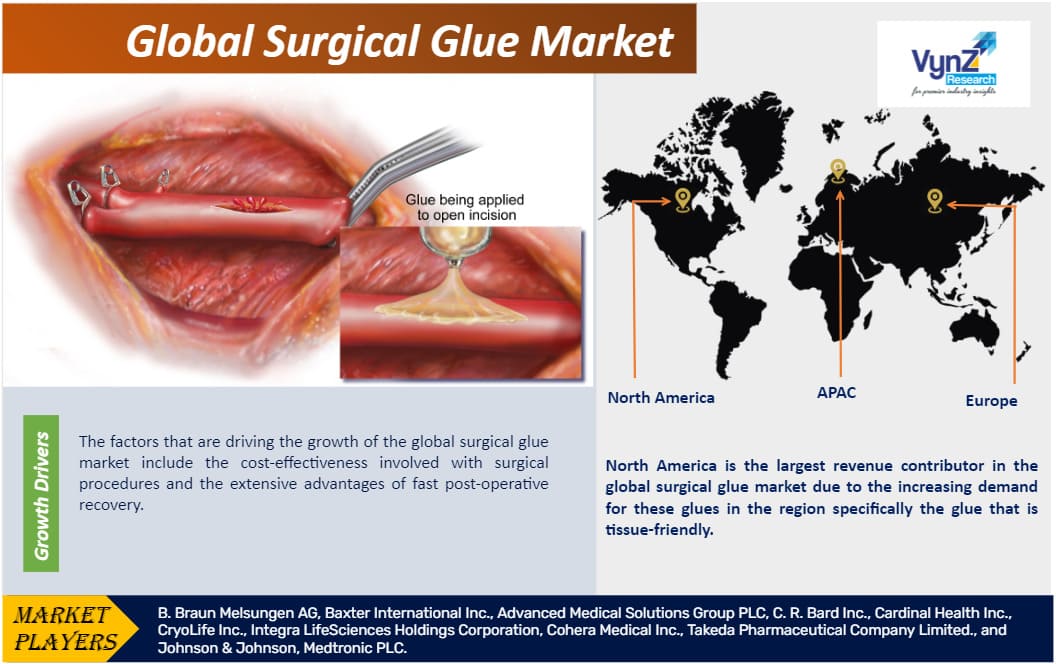 Surgical Glue Market  Global Analysis Report 2027