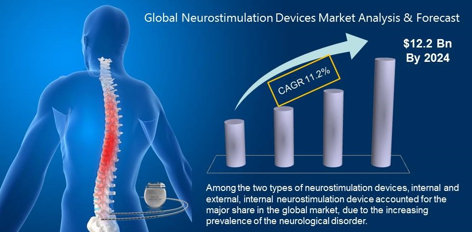 Neurostimulation Device Market Highlights